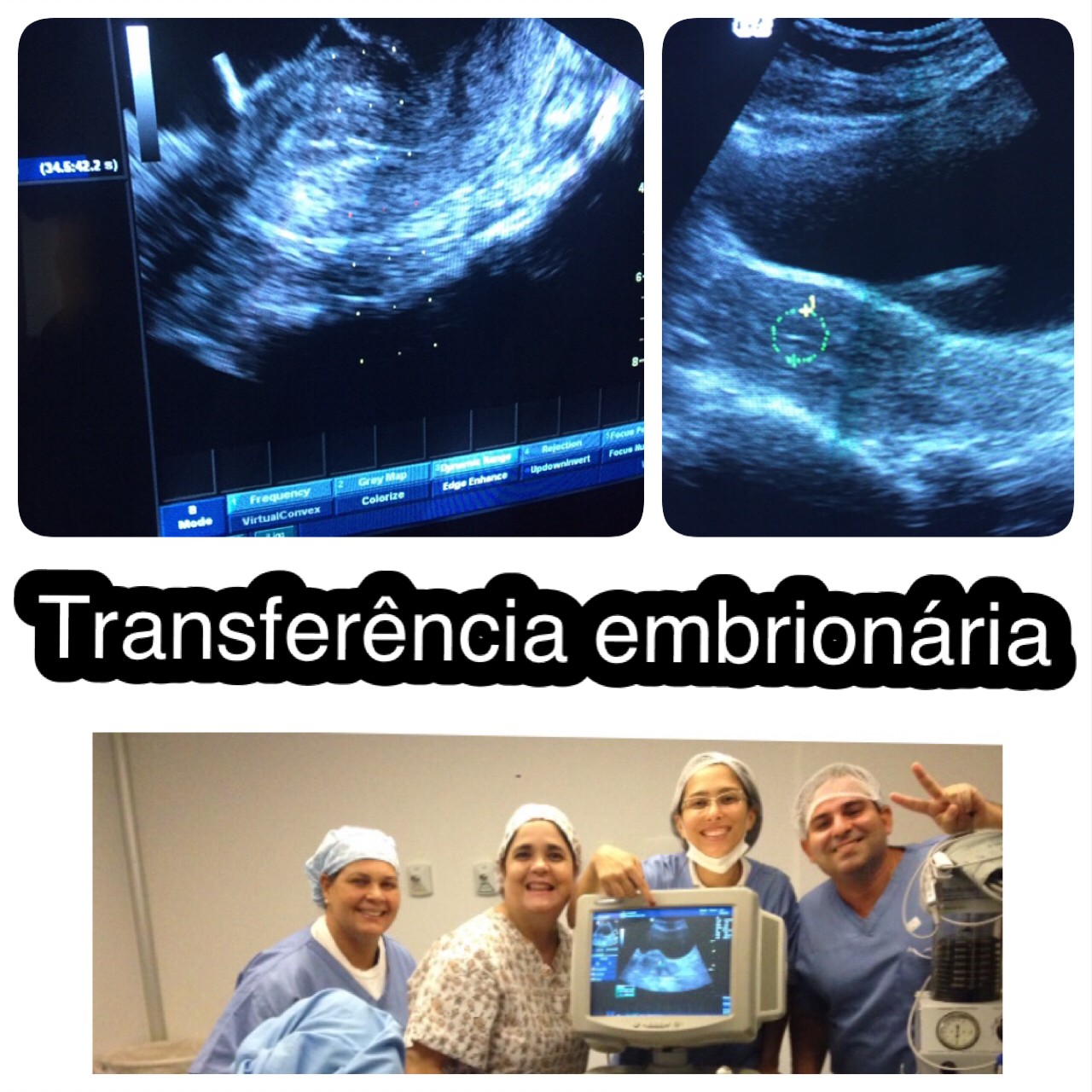 Transferência Embrionária